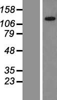 KIAA0240 (GLTSCR1L) Human Over-expression Lysate