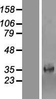 PARM 1 (PARM1) Human Over-expression Lysate