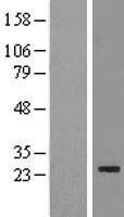 EEF1AKMT3 Human Over-expression Lysate
