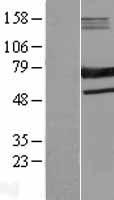 SAMHD1 Human Over-expression Lysate
