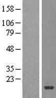 C1orf144 (SZRD1) Human Over-expression Lysate
