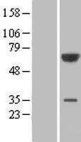 PGM3 Human Over-expression Lysate