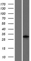 FGFR1OP2 Human Over-expression Lysate