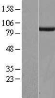 SGSM3 Human Over-expression Lysate