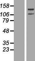 ADAR1 (ADAR) Human Over-expression Lysate