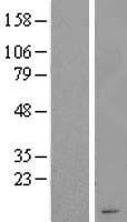 WT1-AS Human Over-expression Lysate