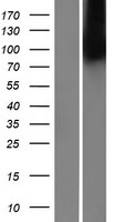 S2P (MBTPS2) Human Over-expression Lysate