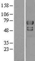 E3 SUMO protein ligase PIAS4 (PIAS4) Human Over-expression Lysate