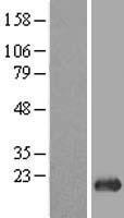 POP5 Human Over-expression Lysate