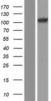 TXNDC11 Human Over-expression Lysate