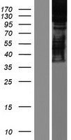 ARS2 (SRRT) Human Over-expression Lysate