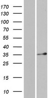 DERA Human Over-expression Lysate