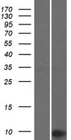 CCDC72 (TMA7) Human Over-expression Lysate