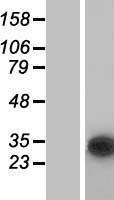 CUTC Human Over-expression Lysate