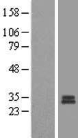 MRPS7 Human Over-expression Lysate