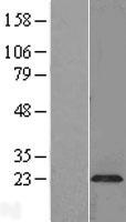 Plasmolipin (PLLP) Human Over-expression Lysate