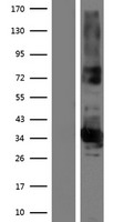 FAM108B1 (ABHD17B) Human Over-expression Lysate