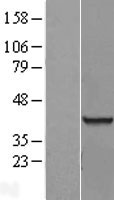 RBMX2 Human Over-expression Lysate