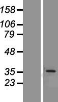 OTUD6B Human Over-expression Lysate