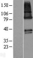 ZDHHC9 Human Over-expression Lysate