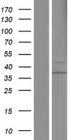 SUV420h1 (KMT5B) Human Over-expression Lysate