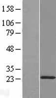 COMMD2 Human Over-expression Lysate