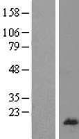 RPL26L1 Human Over-expression Lysate