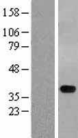STYXL1 Human Over-expression Lysate
