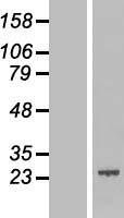 C2orf28 (ATRAID) Human Over-expression Lysate