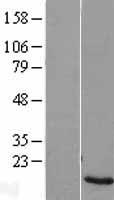 ZNF706 Human Over-expression Lysate