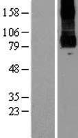 PKD2L1 Human Over-expression Lysate
