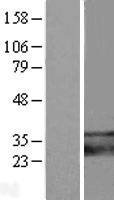 TMEM66 (SARAF) Human Over-expression Lysate
