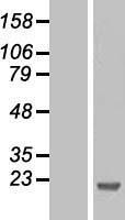 NIP7 Human Over-expression Lysate