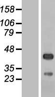 C5orf45 (MRNIP) Human Over-expression Lysate