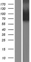 PADI3 Human Over-expression Lysate