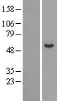 epsilon Tubulin (TUBE1) Human Over-expression Lysate