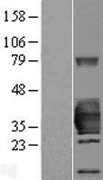 HSD17B14 Human Over-expression Lysate
