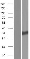 HSD17B11 Human Over-expression Lysate