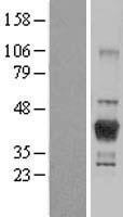 LCMT1 Human Over-expression Lysate