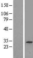 CWC15 Human Over-expression Lysate