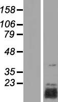 TRIAP1 Human Over-expression Lysate