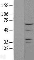 CTDSPL2 Human Over-expression Lysate
