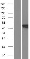 PTPLAD1 (HACD3) Human Over-expression Lysate