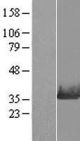 VCX3A Human Over-expression Lysate