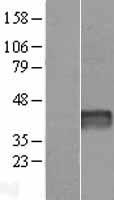DRICH1 Human Over-expression Lysate