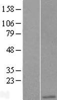 Apc11 (ANAPC11) Human Over-expression Lysate