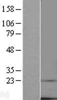 TMEM14C Human Over-expression Lysate