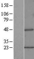 Sarcosine Oxidase (PIPOX) Human Over-expression Lysate