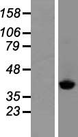 SCLY Human Over-expression Lysate