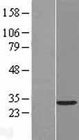 RASL12 Human Over-expression Lysate